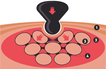 Preview: TMX® TRIGGER ORIGINAL Trigger Tool