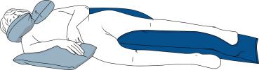 SHP CAREPUR Seitlagerungskissen 30° und 135°